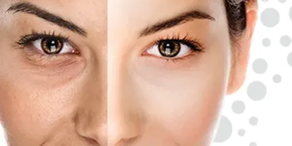 5-in-1 super facial